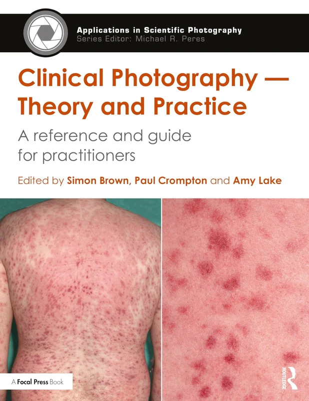 Clinical Photography ― Theory and Practice: A Reference and Guide for Practitioners (Applications in Scientific Photography)