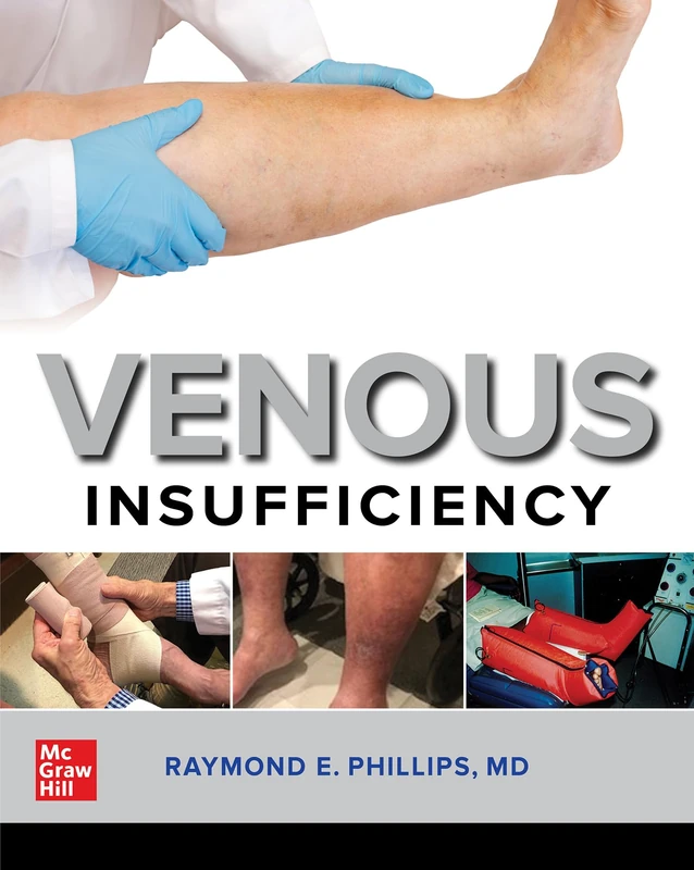 McGraw-Hill Venous Insufficiency - Internal Medicine Guide