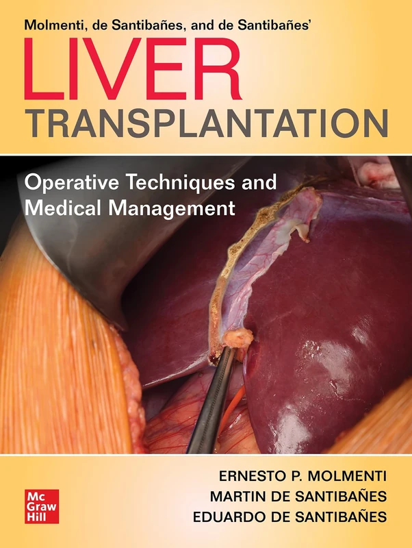 Liver Transplantation: Operative Techniques and Medical Management (SURGERY)