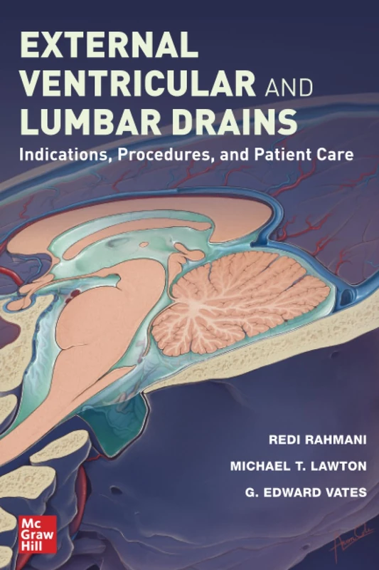 External Ventricular and Lumbar Drains: Indications, Procedures, and Patient Care - Image 1