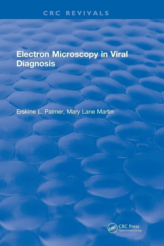 Electron Microscopy in Viral Diagnosis