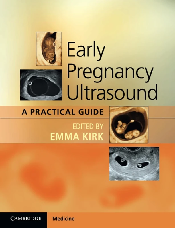 Early Pregnancy Ultrasound: A Practical Guide