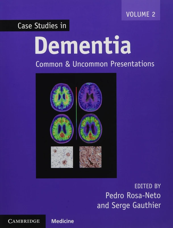 Case Studies in Dementia: Common and Uncommon Presentations (Case Studies in Neurology)