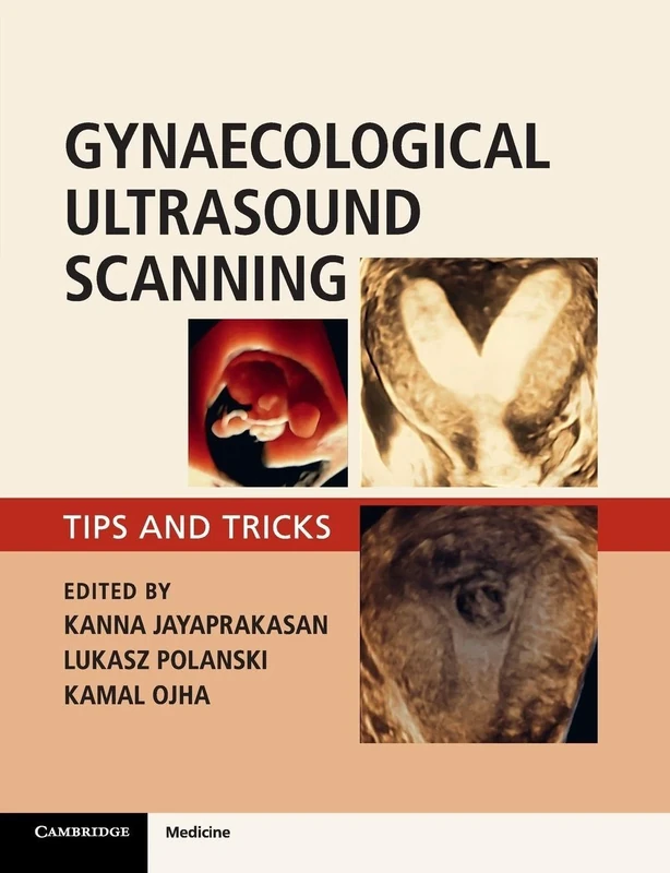 Gynaecological Ultrasound Scanning: Tips and Tricks