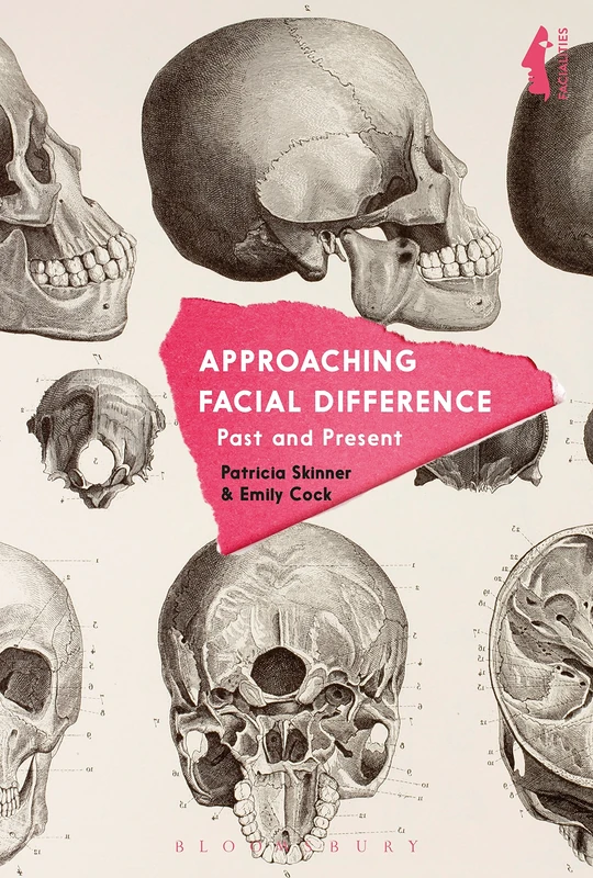 Approaching Facial Difference: Past and Present (Facialities: Interdisciplinary Approaches to the Human Face)