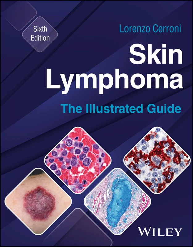 Wiley Skin Lymphoma: The Illustrated Guide - 6th Edition