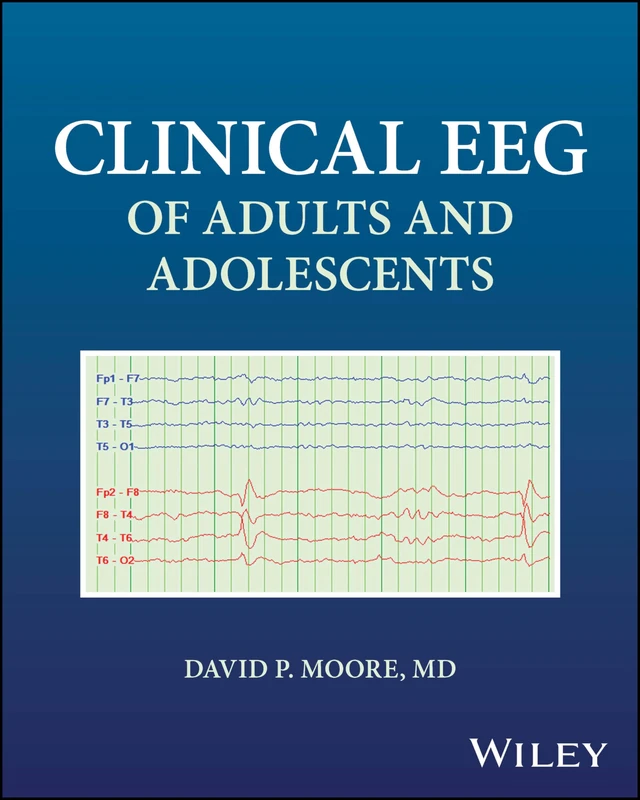Clinical EEG of Adults and Adolescents - Image 1