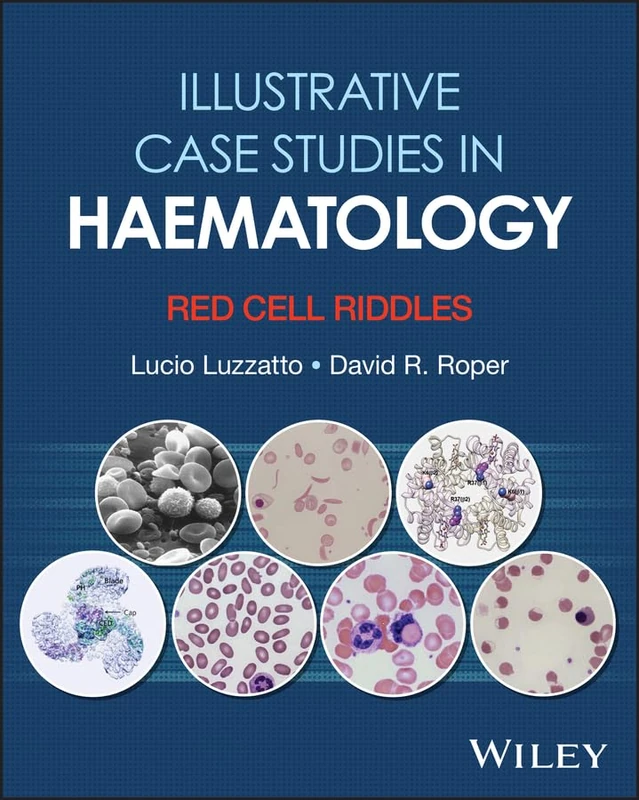 Illustrative Case Studies in Haematology: Red Cell Riddles
