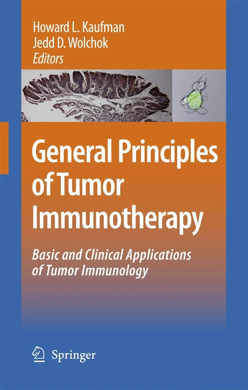 General Principles of Tumor Immunotherapy: Basic and Clinical Applications of Tumor Immunology