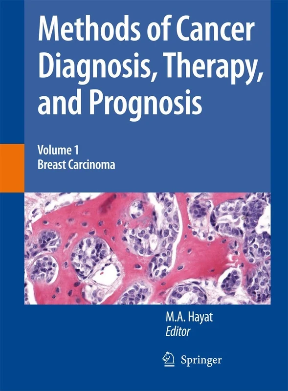 Methods of Cancer Diagnosis, Therapy and Prognosis: Breast Carcinoma: 1 (Methods of Cancer Diagnosis, Therapy and Prognosis, 1)