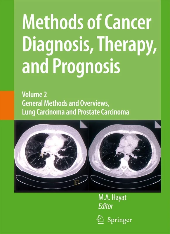 Methods of Cancer Diagnosis, Therapy and Prognosis: General Methods and Overviews, Lung Carcinoma and Prostate Carcinoma: 2 (Methods of Cancer Diagnosis, Therapy and Prognosis, 2)