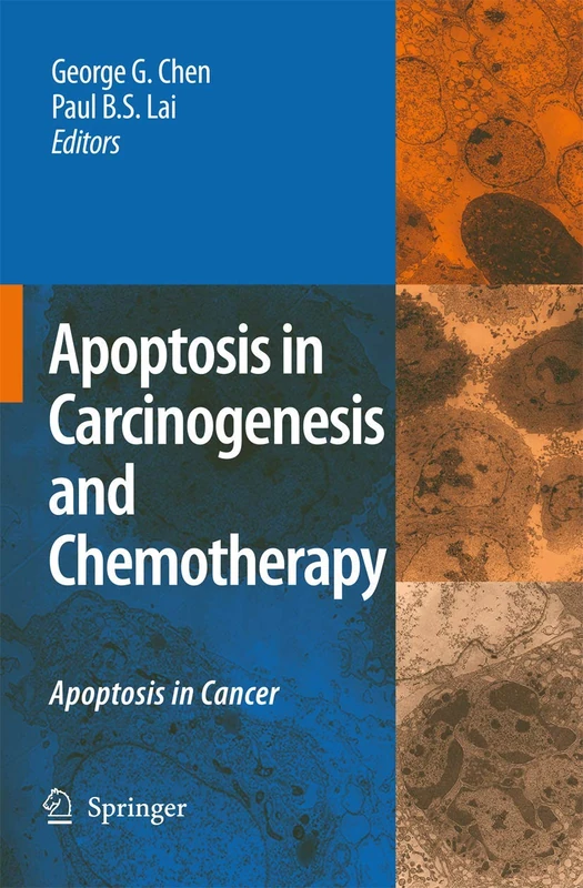 Apoptosis in Carcinogenesis and Chemotherapy: Apoptosis in cancer