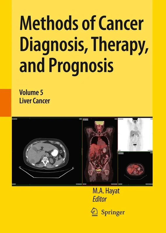 Methods of Cancer Diagnosis, Therapy, and Prognosis: Liver Cancer: 5