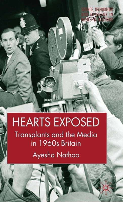 Hearts Exposed: Transplants and the Media in 1960s Britain