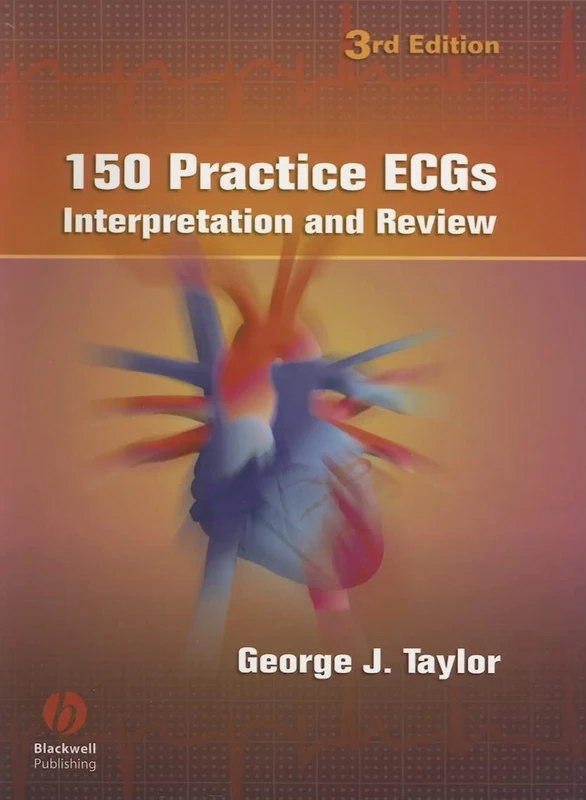 150 Practice ECGs: Interpretation and Review