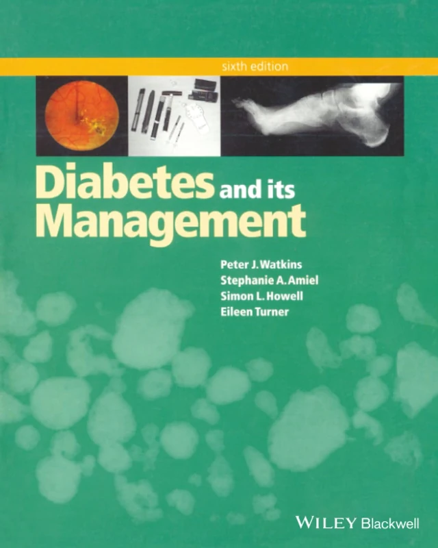 Diabetes and Its Management