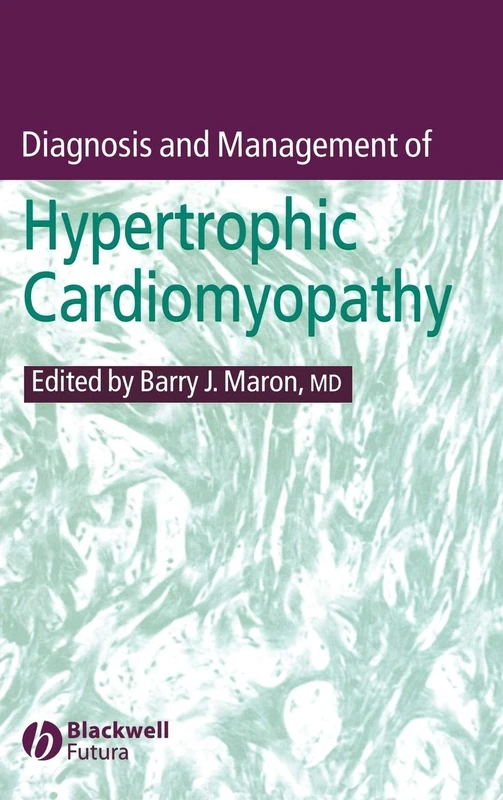 Diagnosis and Management of Hypertrophic Cardiomyopathy