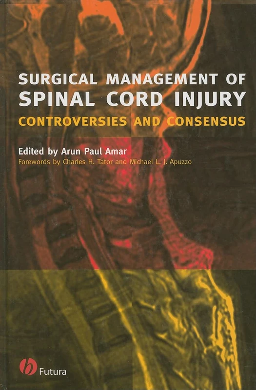 Surgical Management of Spinal Cord Injury: Controversies and Consensus