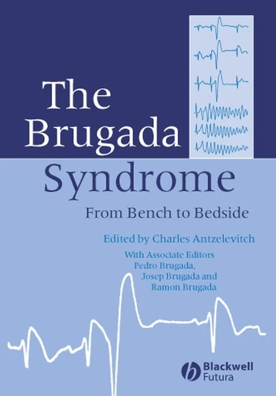 The Brugada Syndrome: From Bench To Bedside