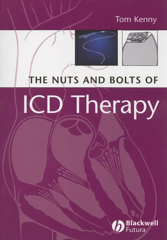 The Nuts and Bolts of ICD Therapy: 5 (Nuts and Bolts Series (Replaced by 5113))
