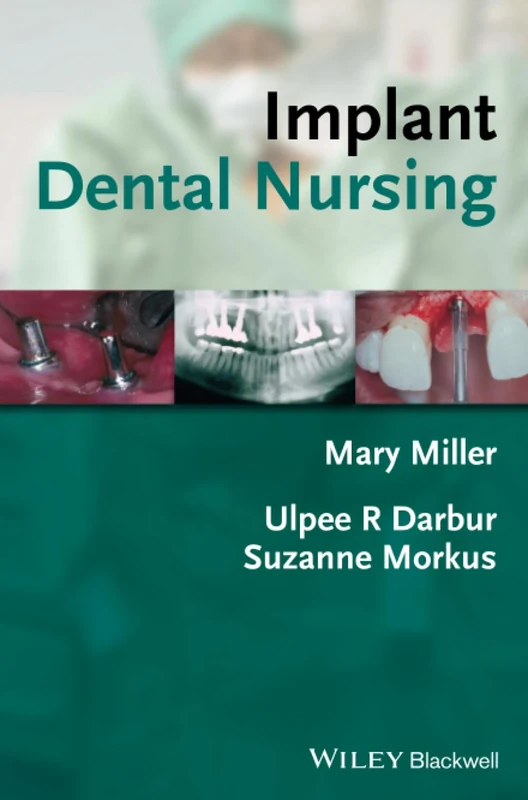 Implant Dental Nursing