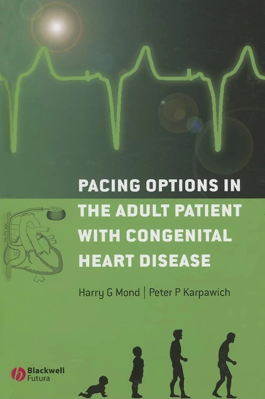 Pacing Options in the Adult Patient with Congenital Heart Disease - Image 1