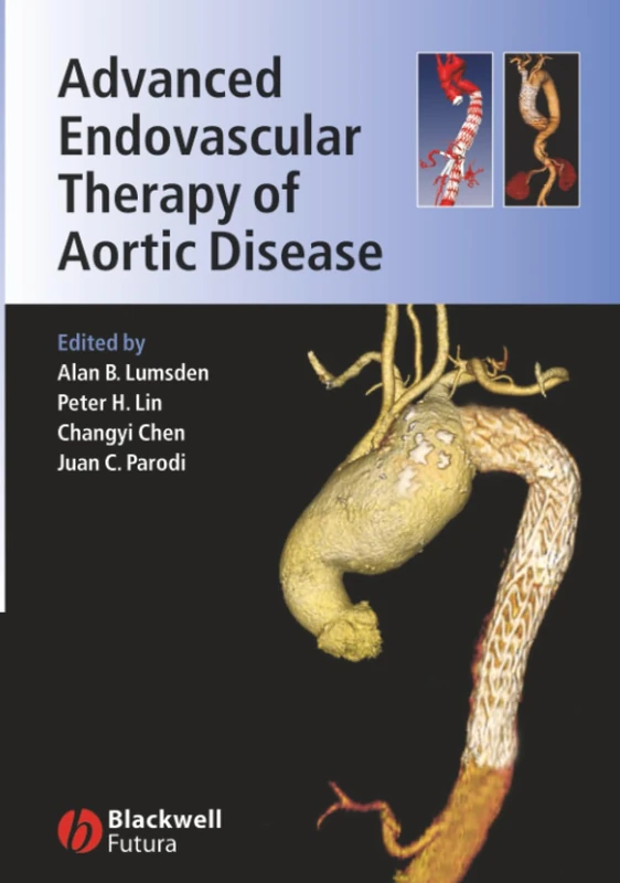 Advanced Endovascular Therapy of Aortic Disease