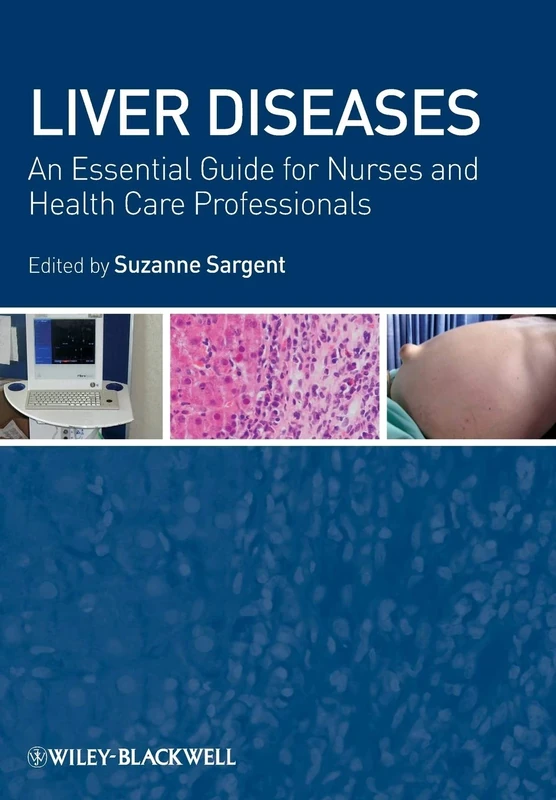 Liver Diseases: An Essential Guide for Nurses and Health Care Professionals