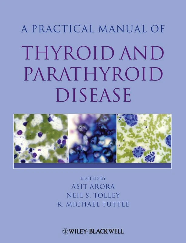 Practical Manual of Thyroid and Parathyroid Disease: 2 (Practical Manual of Series)