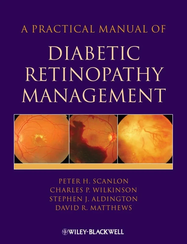 A Practical Manual of Diabetic Retinopathy Management (Practical Manual of Series)