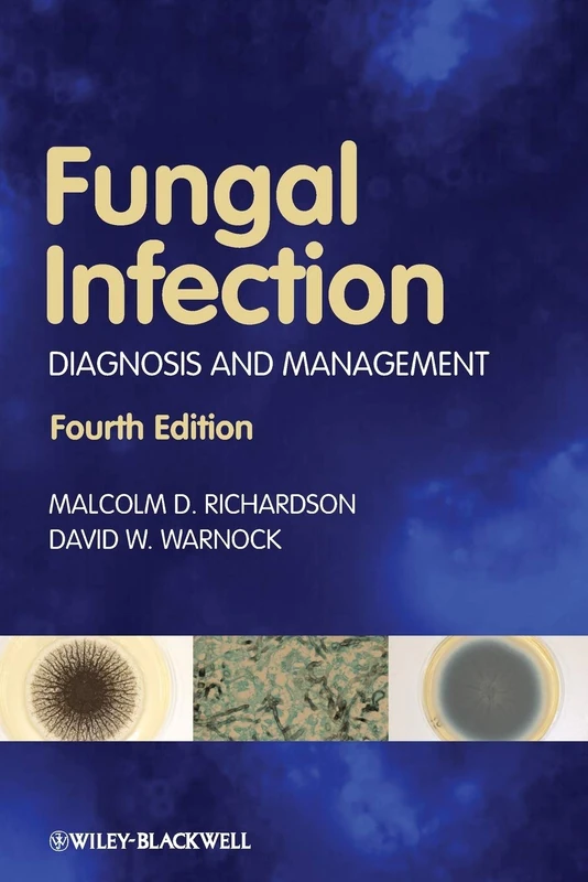 Fungal Infection: Diagnosis and Management, 4th Edition