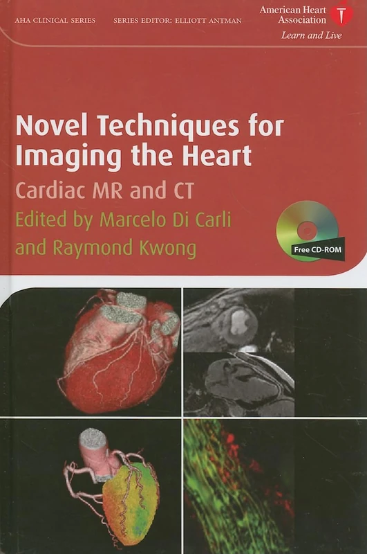 Novel Techniques for Imaging the Heart: Cardiac MR and CT (American Heart Association Clinical Series)