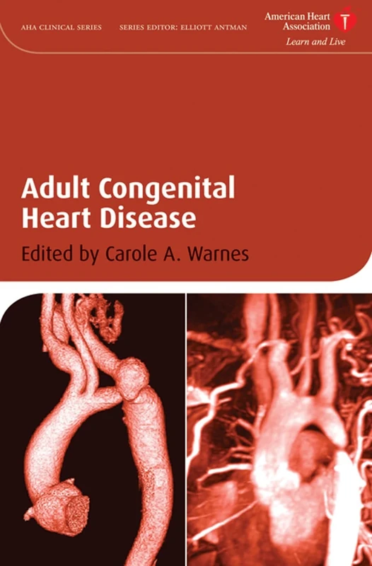 Adult Congenital Heart Disease: 12 (American Heart Association Clinical Series)