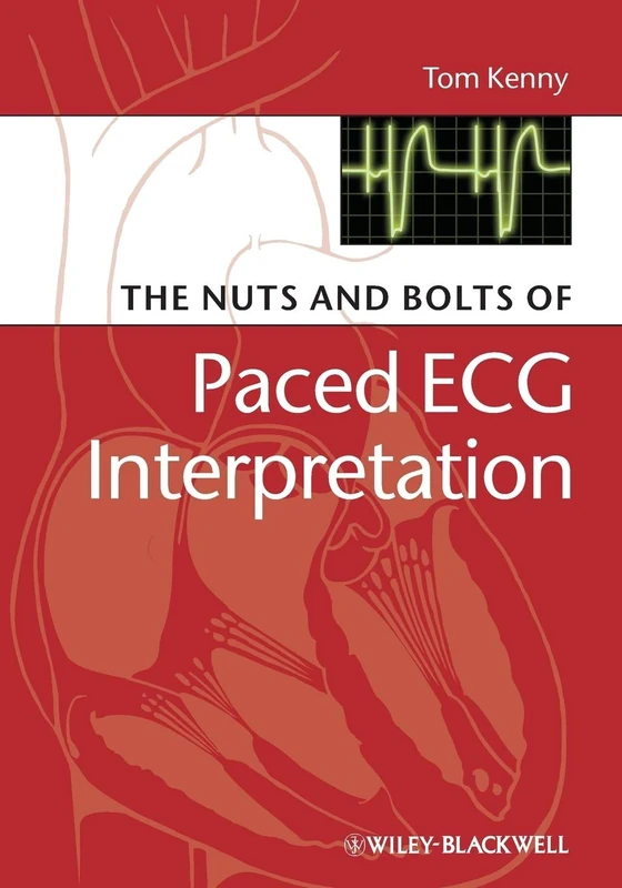 The Nuts and Bolts of Paced ECG Interpretation: 4 (Nuts and Bolts Series (Replaced by 5113))