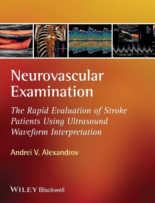 Neurovascular Examination: The Rapid Evaluation of Stroke Patients Using Ultrasound Waveform Interpretation
