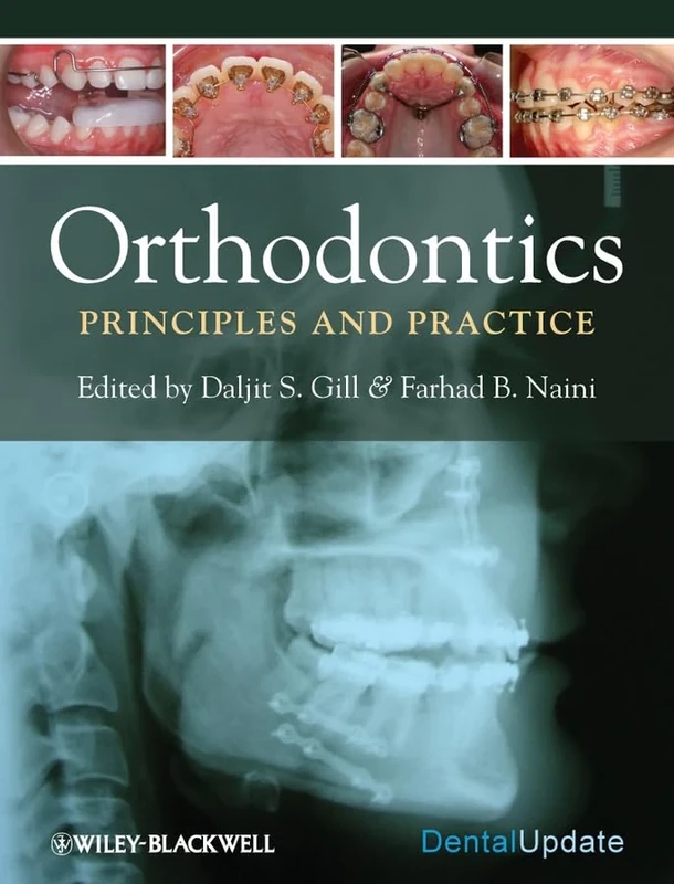 Orthodontics: Principles and Practice
