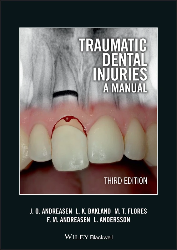 Traumatic Dental Injuries: A Manual, 3rd Edition