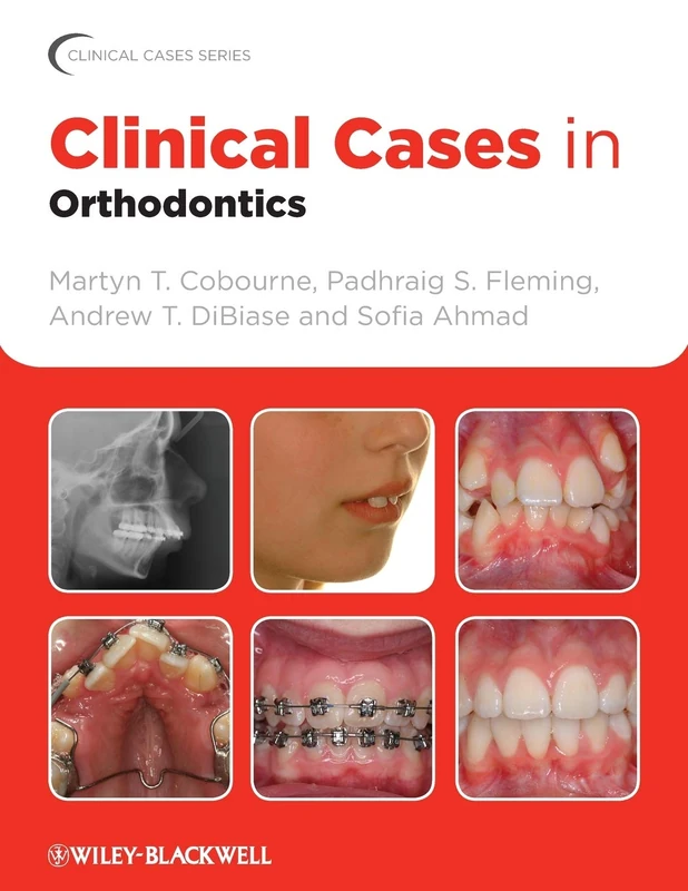 Clinical Cases in Orthodontics (Clinical Cases Uncovered)