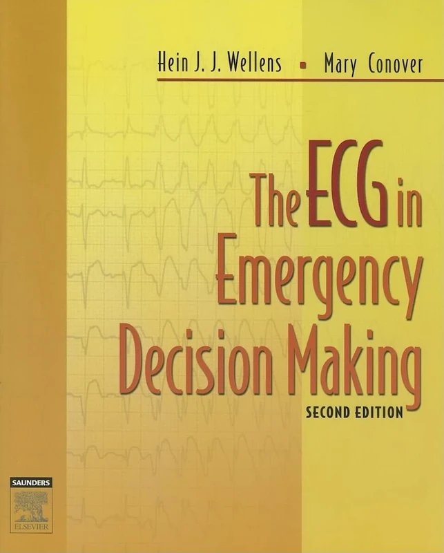 The ECG in Emergency Decision Making