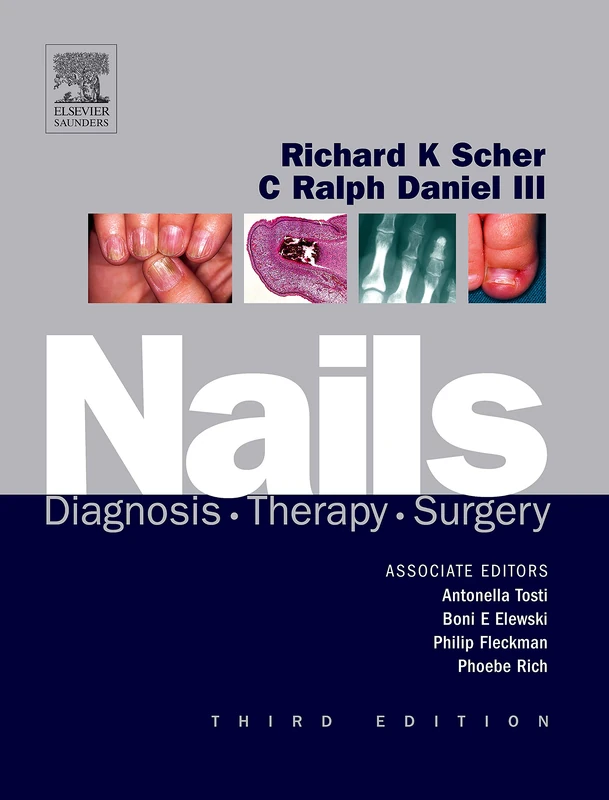 Nails: Diagnosis, Therapy, Surgery