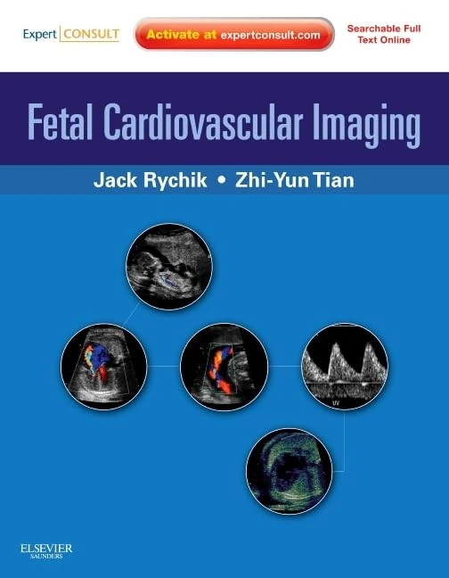 Fetal Cardiovascular Imaging: A Disease Based Approach: Expert Consult Premium Edition: Enhanced Online Features and Print