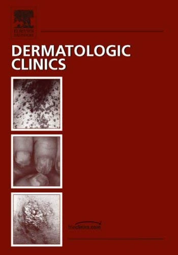 Women's Dermatology: An Issue of Dermatologic Clinics: v. 24-2 (The Clinics: Dermatology)
