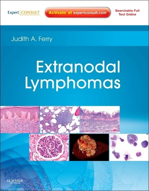 Saunders Extranodal Lymphomas: Expert Consult - Online and Print