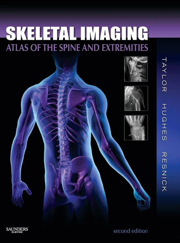 Skeletal Imaging: Atlas of the Spine and Extremities