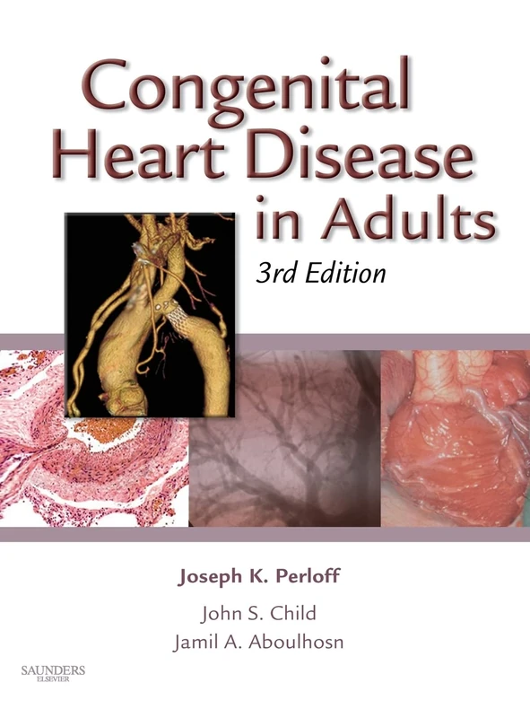 Congenital Heart Disease in Adults