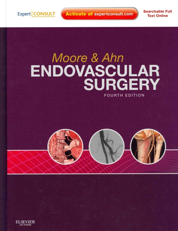 Endovascular Surgery: Expert Consult - Online and Print, with Video