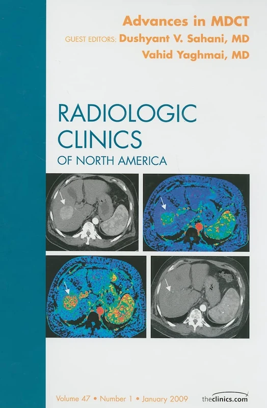 Advances in MDCT, An Issue of Radiologic Clinics (Volume 47-1) (The Clinics: Radiology, Volume 47-1)