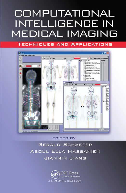 Computational Intelligence in Medical Imaging: Techniques and Applications