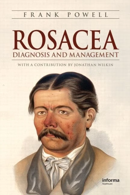 Rosacea: Diagnosis and Management - Image 1