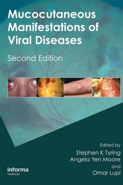 Mucocutaneous Manifestations of Viral Diseases: An Illustrated Guide to Diagnosis and Management
